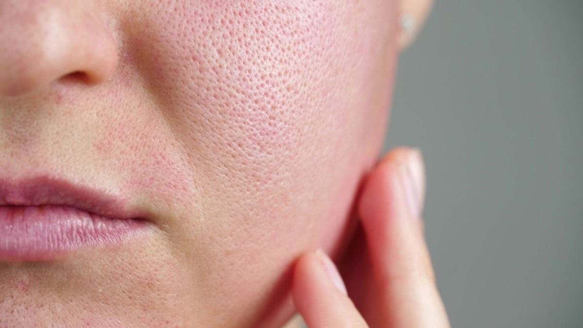 akademisk Reklame På kanten 33 Best & Worst Ingredients for Sensitive Skin | Expert Advice