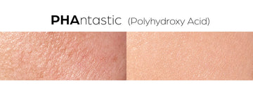 (stock image) of skin before and after chemical exfoliation