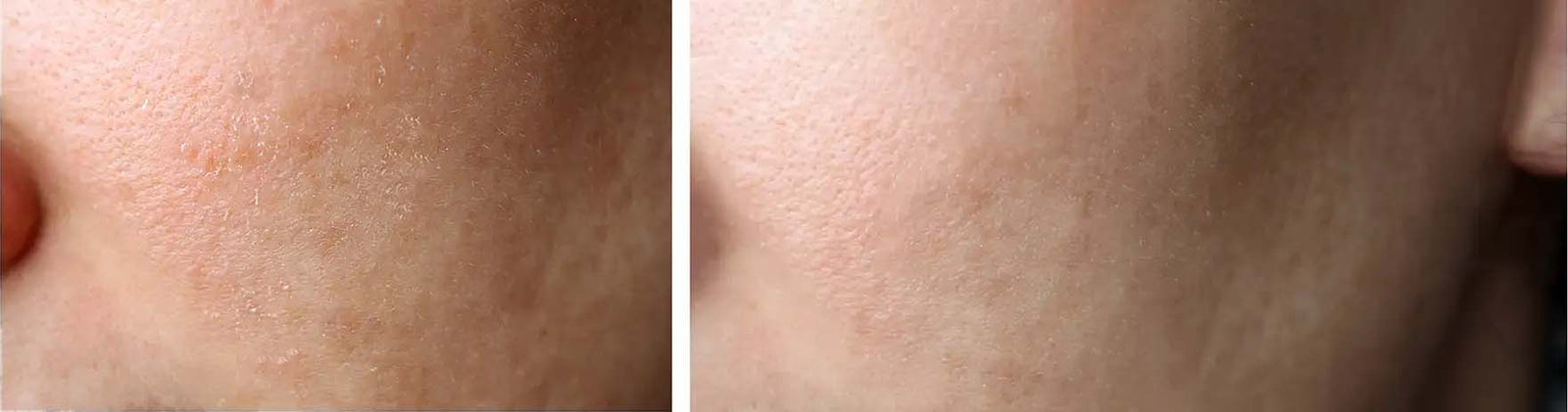 bareLUXE Natural face scrub before and after